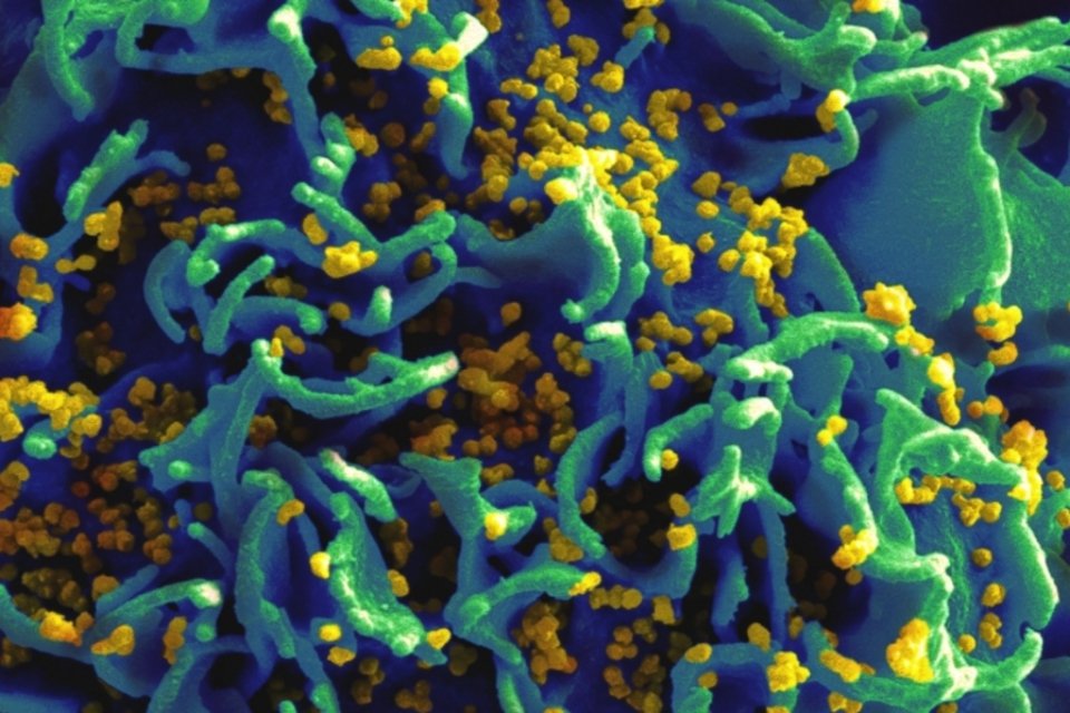 OMS recomenda administração de antirretrovirais a todos os pacientes infectados pelo HIV