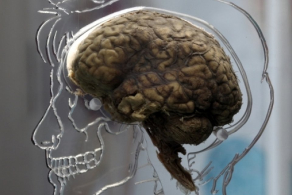 Quando surge o cérebro? (Getty Images)