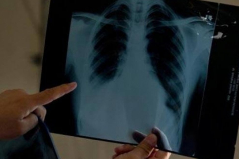 Órgão criado na pandemia mantém homem vivo por 48 horas até transplante