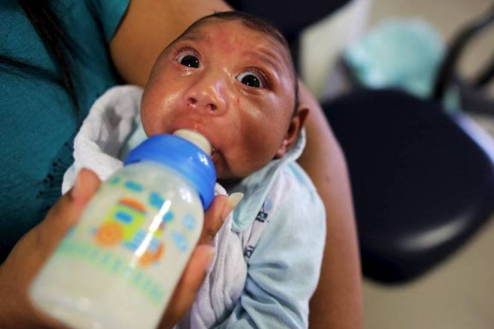 Brasil tem 1.656 casos confirmados de microcefalia