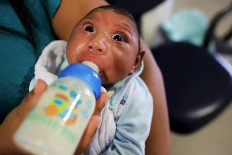 
	Microcefalia: o restante estaria associado a outras causas - como doen&ccedil;as gen&eacute;ticas ou infec&ccedil;&otilde;es por citomegalov&iacute;rus, herpes ou toxoplasmose
 (REUTERS/Nacho Doce)