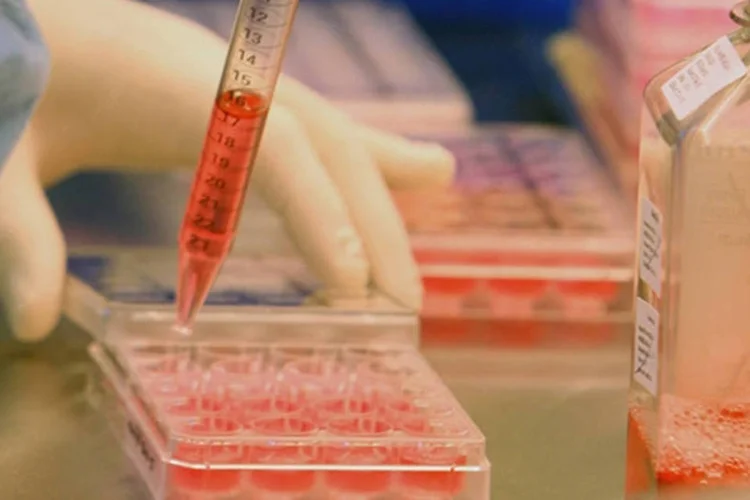 
	Nova prote&iacute;na poderia barrar o crescimento do c&acirc;ncer&nbsp;de p&acirc;ncreas e aumentar a sobreviv&ecirc;ncia dos pacientes em 20%
 (Getty Images)