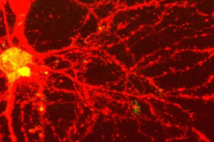 
	Veias sangu&iacute;neas em um c&eacute;rebro: em m&eacute;dio prazo, os novos chips poder&atilde;o ser utilizados na fabrica&ccedil;&atilde;o de rob&ocirc;s para permitir que evoluam de forma aut&ocirc;noma, afirma pesquisador
 (Photopin)