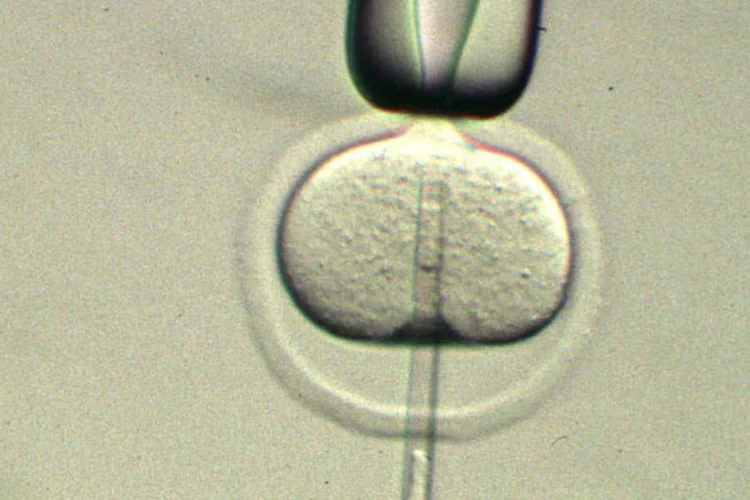
	Insemina&ccedil;&atilde;o artificial: resolu&ccedil;&atilde;o do Conselho Federal de Medicina publicada nesta quarta-feira traz profundas altera&ccedil;&otilde;es nas regras para a fertiliza&ccedil;&atilde;o assistida no pa&iacute;s
 (Getty Images)