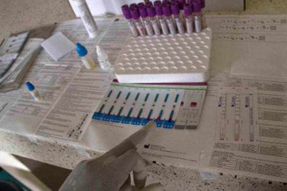 EUA registram 1ª morte por infecção associada a vírus raro