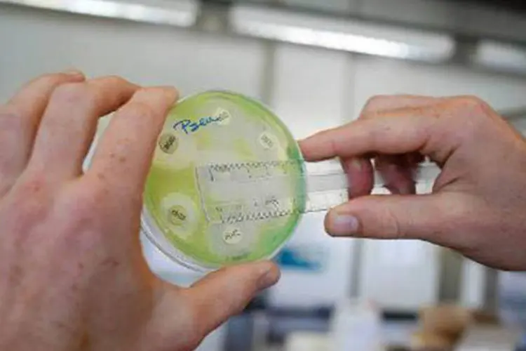 Coleta de bactérias é vista em laboratório de Antuérpia, 13 de agosto de 2013 (Jorge Dirkx/Reuters)