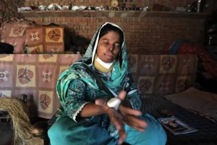 Mulher vítima de ataque com ácido no Paquistão (Bay Ismoyo/AFP)