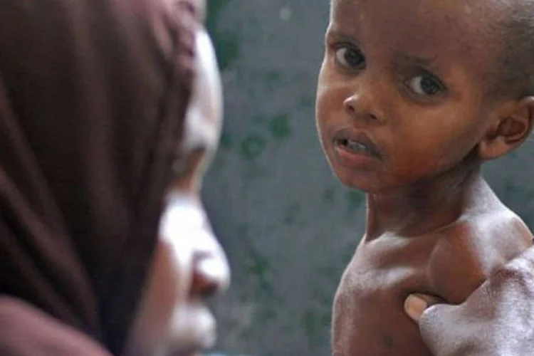 Relatório exalta ''um duro paradoxo: em um mundo com excedente de comida, a fome e a desnutrição continuam onipresentes em um continente com grandes recursos" (Mustafa Abdi/AFP)