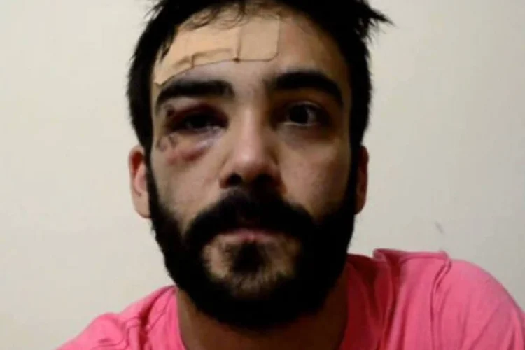  O estudante André Baliera divulgou na quarta-feira (05) no YouTube um vídeo no qual reafirma que houve uma tentativa de homicídio e que ser gay nunca foi fácil (Reprodução/Youtube)