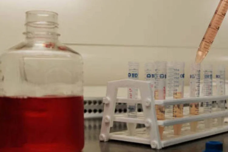 
	Aids: os cientistas comprovaram que a muta&ccedil;&atilde;o reduz a capacidade das c&eacute;lulas mieloide de capturar o v&iacute;rus
 (.)