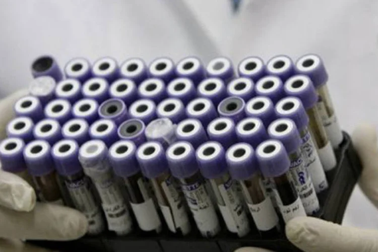 
	Amostras em laborat&oacute;rio: S&atilde;o Paulo &eacute; a cidade que ter&aacute; a maior verba - R$ 370 mil
 (Joseph Eid/AFP)