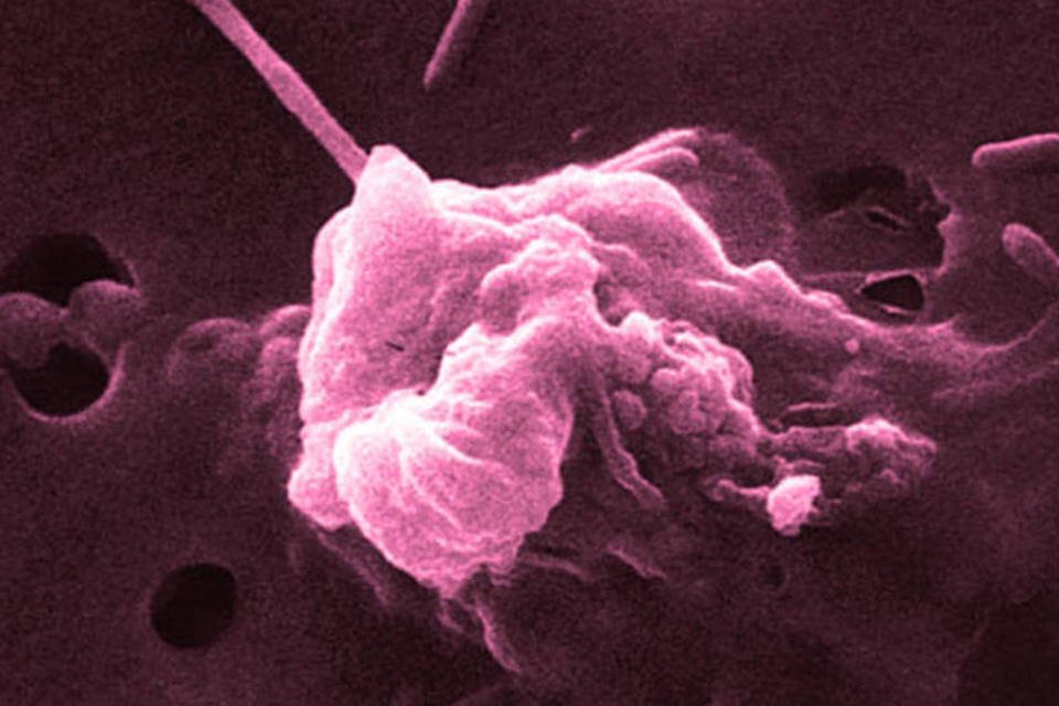 Novo reagente facilita a detecção de células cancerígenas