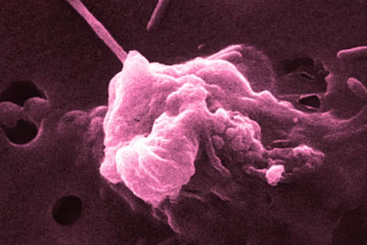 Anualmente, são registrados cerca de 4.800 novos casos destes dois tipos de câncer em menores de 21 anos (National Cancer Institute)