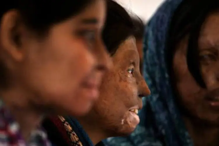 Sobreviventes de ataques com ácido se reúnem em Nova Deli (Chandan Khanna/AFP)