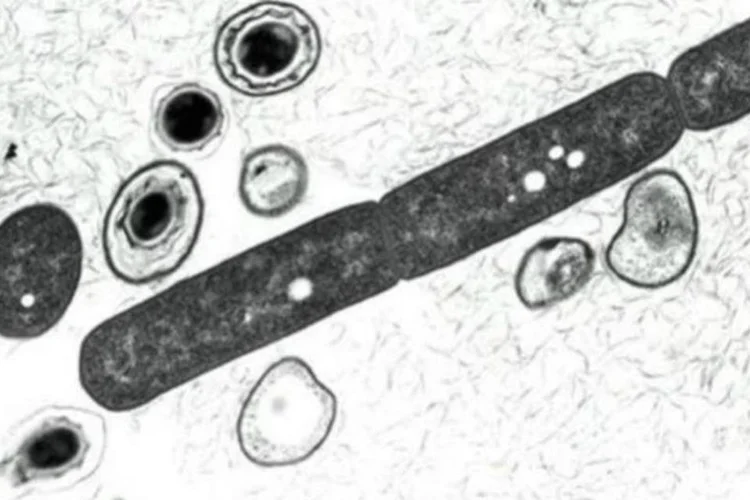 Antraz: cientistas preparavam amostras do "Bacillus anthracis" (antraz) para serem analisadas (DOD/AFP/Arquivos)