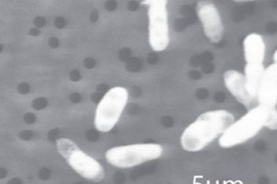 Revista admite erro em pesquisa de "bactéria ET"