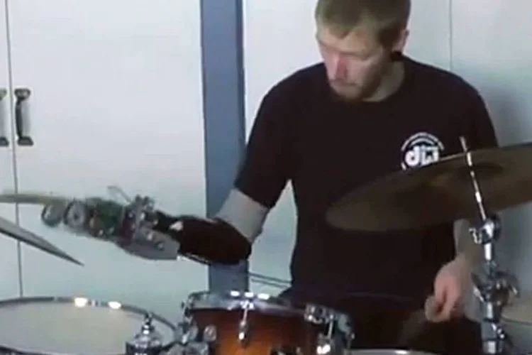Barnes tocando bateria usando o implante mecânico (YouTube/New Scientist)