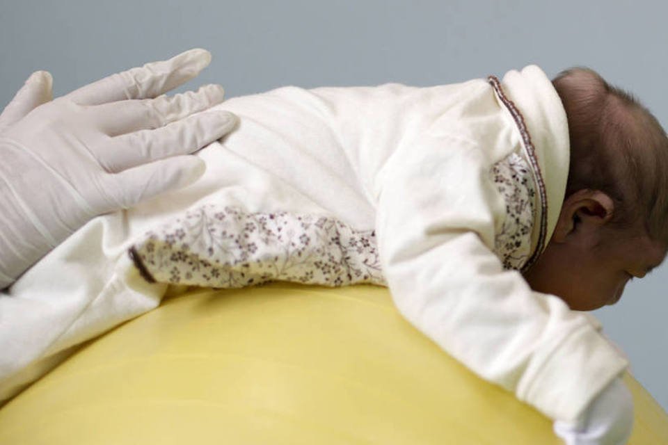 Terapias aliviam desconforto de bebês com microcefalia
