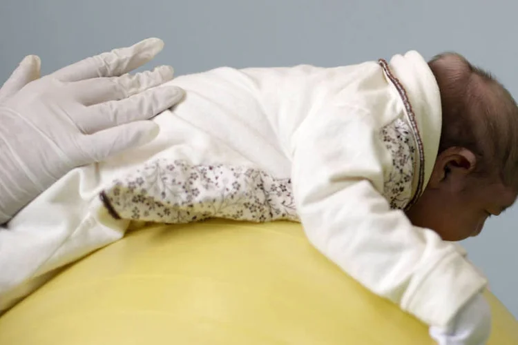 
	Beb&ecirc; com microcefalia: no boletim anterior, divulgado na semana passada, o pa&iacute;s tinha 907 casos confirmados de microcefalia
 (Ricardo Moraes / Reuters)