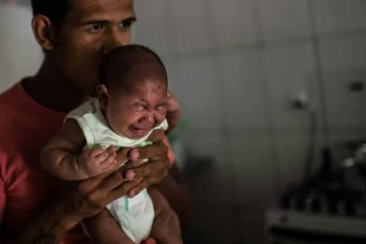 Matheus Lima segura seu bebê, Pietro, que sofre de microcefalia (CHRISTOPHE SIMON/AFP)