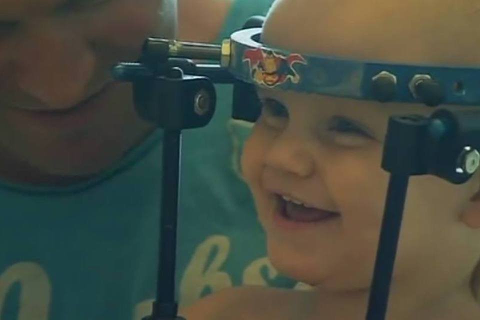 Médicos reconectam cabeça de bebê após decapitação interna