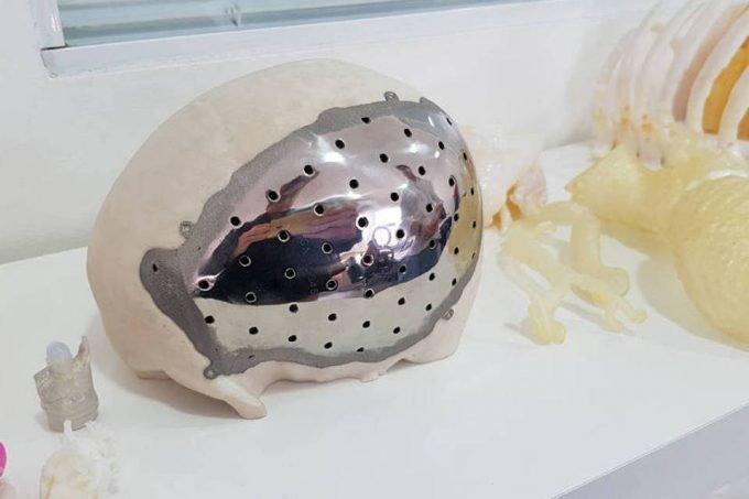 Startup cria próteses personalizadas com impressão 3D