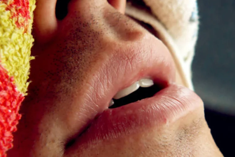 Boca seca pode causar  mau hálito, lábios ressecados, dor de garganta, alteração no paladar, dificuldade na fala, dificuldade de engolir alimentos e, principalmente, aumento de cáries, infecções periodontais e inflamações gengivais  (sxc.hu)