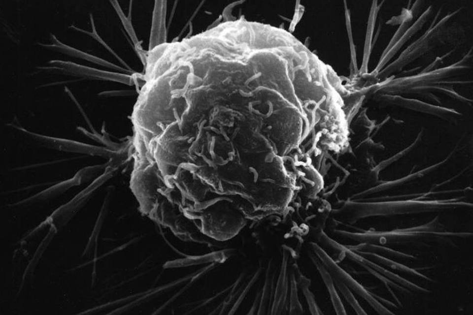 Como a bioinformática está ajudando no tratamento do câncer