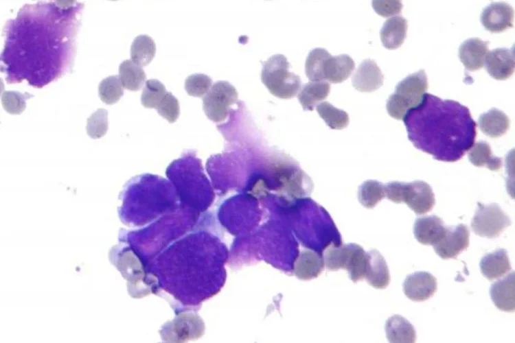 
	C&acirc;ncer: a a&ccedil;&atilde;o da fosfoetanolamina em c&eacute;lulas cancer&iacute;genas &eacute; estudada desde o come&ccedil;o dos anos 90
 (Wikimedia commons)