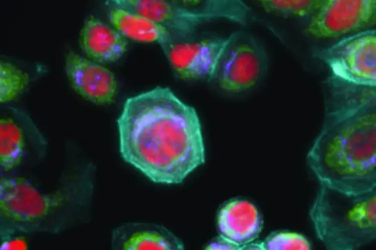 Câncer: pesquisadores descobrem forma de parar a reprodução do vírus (Ge Healthcare/Flickr)
