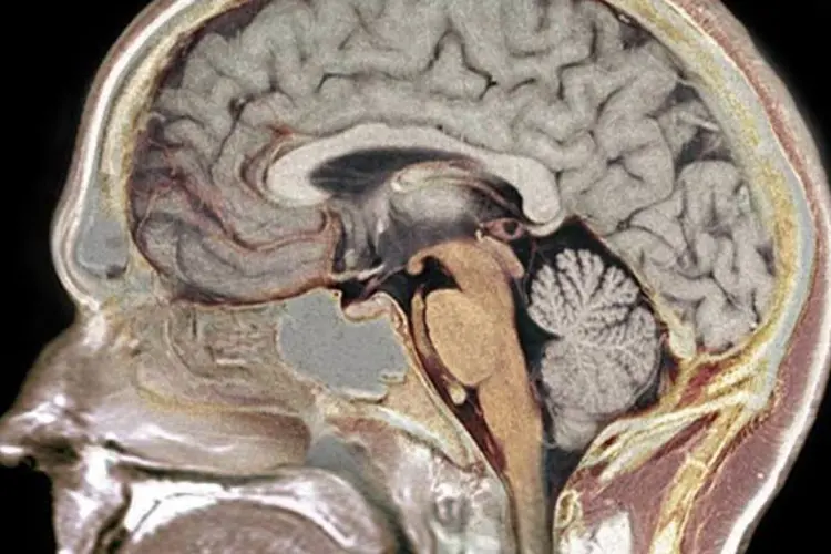 Cérebro humano (Garpenholm/Wikimedia Commons)