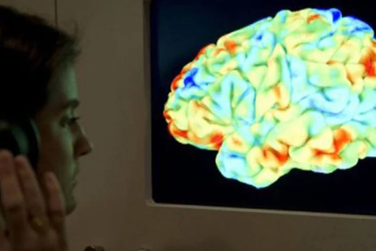 Mutação do gene TREM2, que ajuda nas respostas do sistema imunológico, é mais frequente em idosos com Alzheimer
 (Miguel Medina/AFP/AFP)