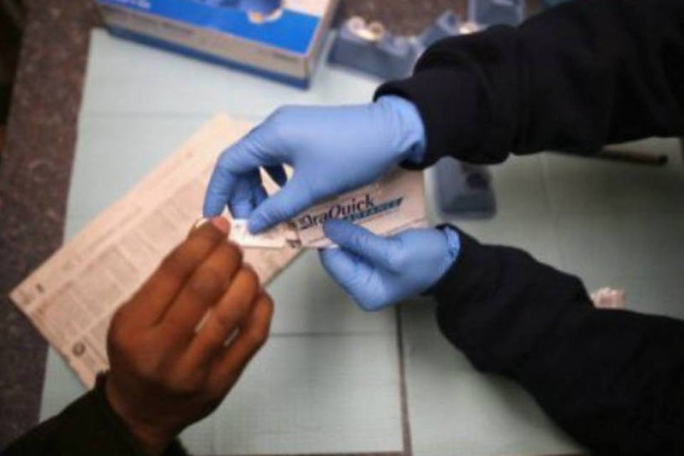 Cientistas criam novo teste para detectar anticorpos da Aids