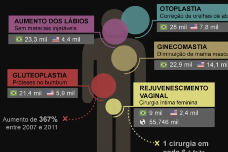 Infográfico: Cirurgia plástica no Brasil (Beatriz Blanco / EXAME.com)