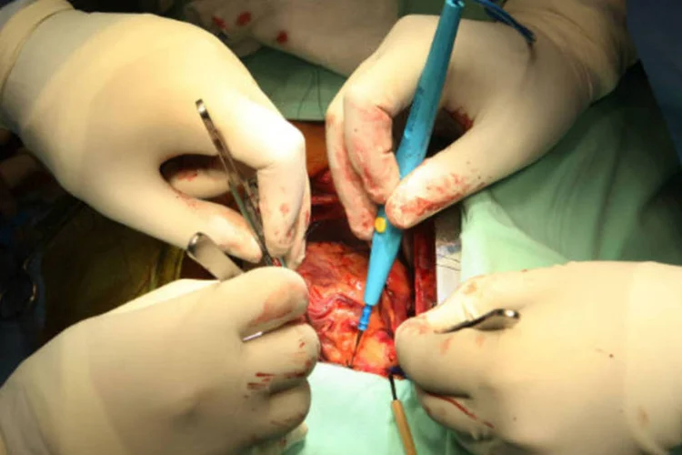 
	Por &oacute;rg&atilde;o transplantado, o resultado mostra que o estado fez 167 cirurgias de transplante de c&oacute;rnea, 39 de rim e 30 de medula &oacute;ssea
 (David Silverman/Getty Images)