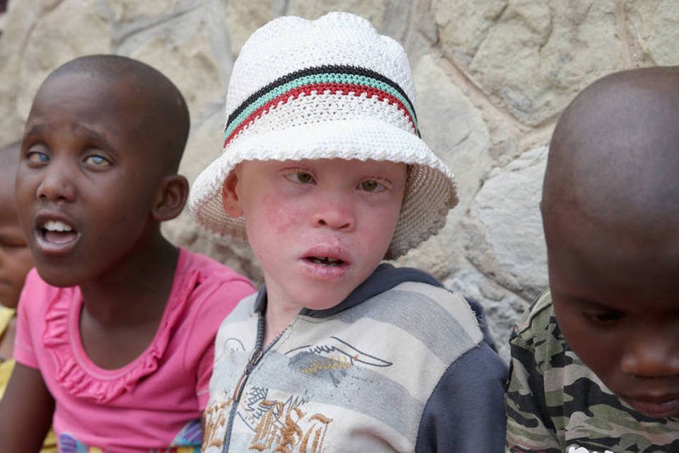 Criança albina em Lesoto: superstição em relação a esse grupo é comum em países da África (Chris Jackson / Staff)