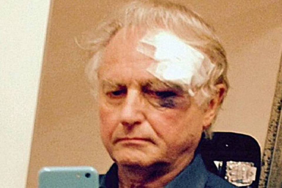 Richard Dawkins: o biólogo inglês caiu de cara no show e ficou com um olho roxo (Reprodução)