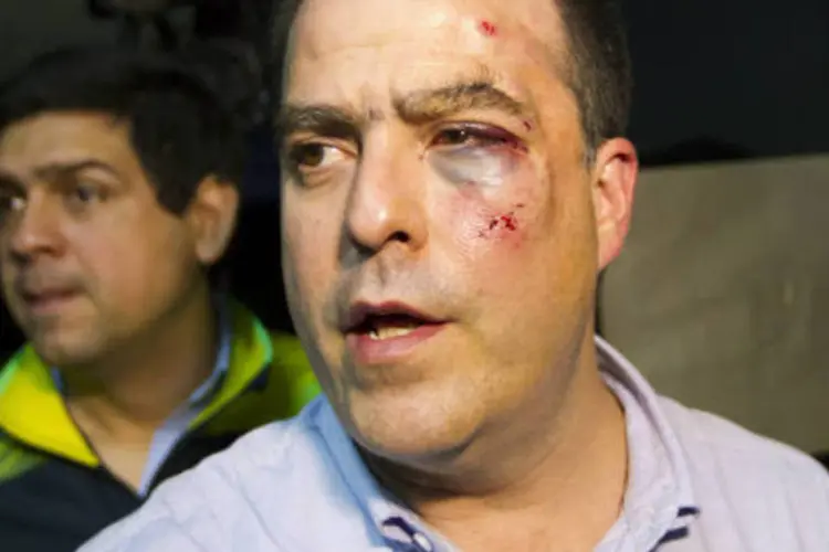 
	O parlamentar da oposi&ccedil;&atilde;o Venezuelana Julio Borges sai machucado:&nbsp;segundo a oposi&ccedil;&atilde;o, dez deputados de sua bancada, e de acordo com o Governo quatro mais da sua, ficaram feridos na sess&atilde;o de ter&ccedil;a-feira.
 (REUTERS/Carlos Garcia Rawlins)