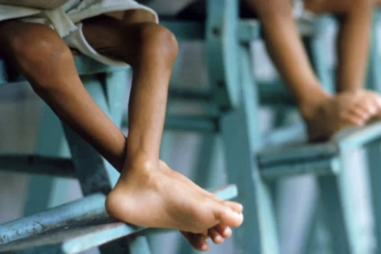 
	Desnutri&ccedil;&atilde;o infantil: a &ldquo;desnutri&ccedil;&atilde;o aguda grave&rdquo; &eacute; definida como fome extrema e &eacute; a principal causa de morte de crian&ccedil;as at&eacute; 5 anos no mundo
 (Getty Images)
