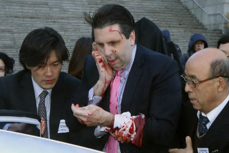 
	O embaixador dos Estados Unidos na Coreia do Sul, Mark Lippert: o ataque o deixou com uma ferida que exigiu 80 pontos
 (Yonhap /Reuters)