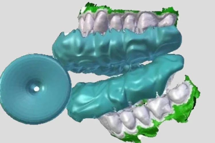 Escova Blizzident: forma de uso é diferente da convencional, já que é preciso mordê-la e esfregar os dentes nela (Divulgação/Blizzident)