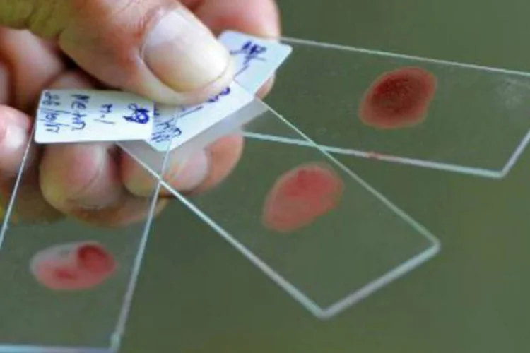 
	Exame de sangue: teste identifica biomarcadores relacionados com a apari&ccedil;&atilde;o de tumores no pr&acirc;ncreas
 (Pornchai Kittiwongsakul/AFP)