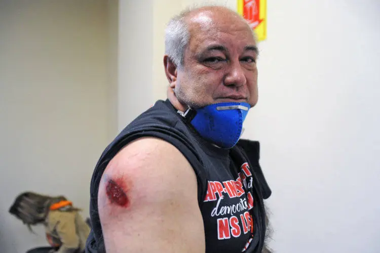 Homem ferido durante confronto entre policiais e professores em Curitiba (Everson Bressan/SMCS)