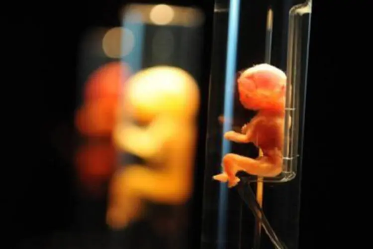 Fetos humanos na exposição 'Bodies 2', em Budapeste: de acordo com as estatísticas russas, 1,2 milhão de abortos são registrados todos os anos na Rússia (©AFP / Attila Kisbenedek/AFP)