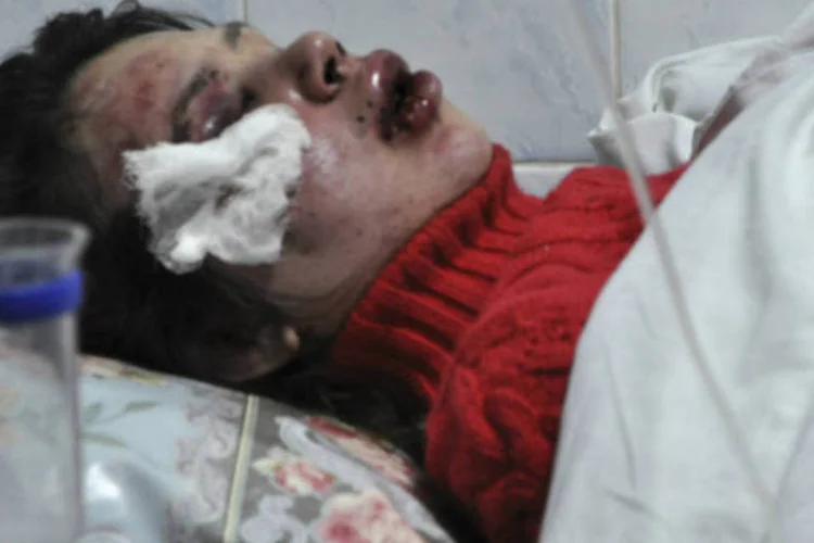 Jornalista opositora Tatiana Chornovil se recupera de agressões: Tatiana foi hospitalizada com o nariz quebrado, concussão cerebral e vários hematomas (Reuters)