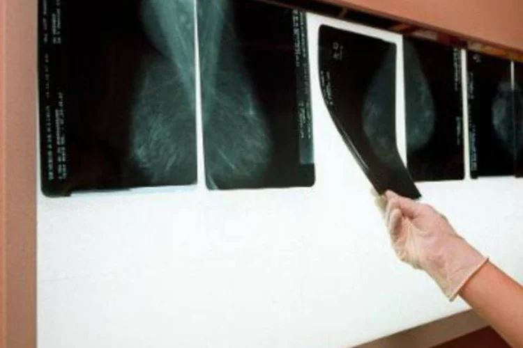 Médico checa exames: utilizado após a retirada do tumor, remédio pode provocar "graves reações na pele" (Didier Pallages/AFP)