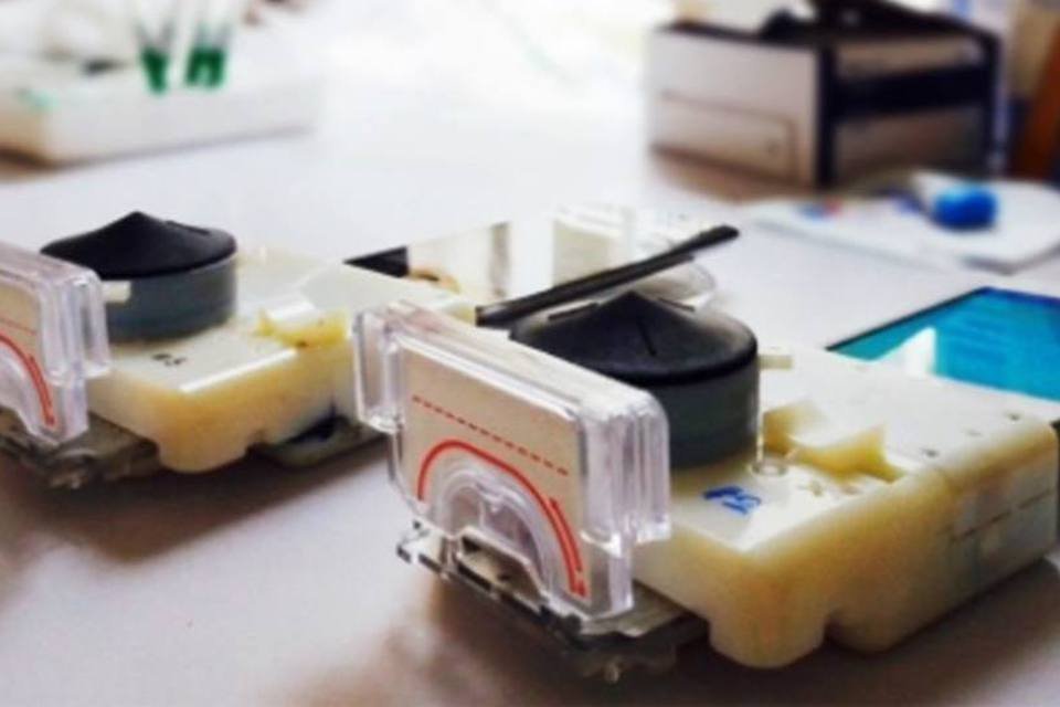 Gadget para smartphones diagnostica HIV em 15 minutos