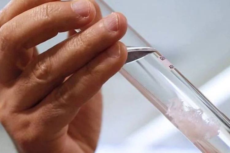 
	Amostra de DNA: testes nos 475 estudantes adolescentes, 31 professores e 21 funcion&aacute;rios da escola Fenelon-Notre Dame, uma institui&ccedil;&atilde;o cat&oacute;lica, podem durar at&eacute; quarta
 (AFP/ Kenzo Tribouillard)