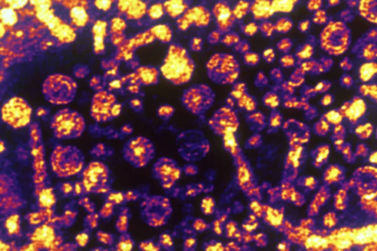 
	Hepatite: doen&ccedil;a pode ser evitada com maior cuidado em atividades corriqueiras
 (Getty Images)