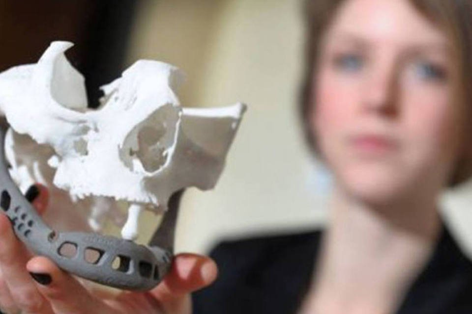 Holanda faz primeiro implante de mandíbula projetada em 3D